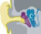 Causas de la pérdida auditiva en el oído interno